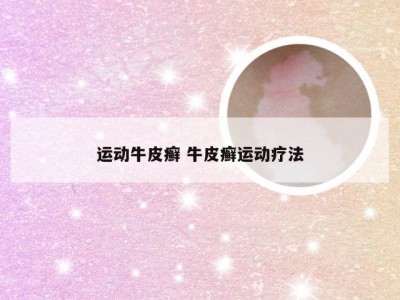 运动牛皮癣 牛皮癣运动疗法