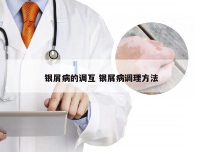 银屑病的调互 银屑病调理方法