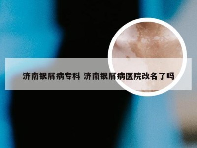 济南银屑病专科 济南银屑病医院改名了吗