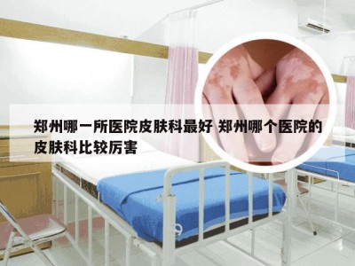 郑州哪一所医院皮肤科最好 郑州哪个医院的皮肤科比较厉害