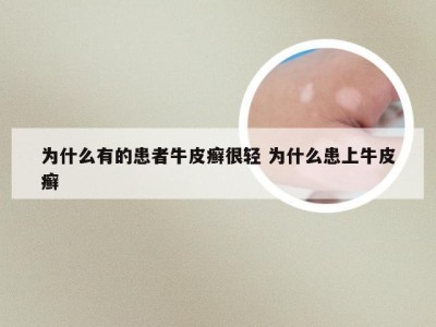 为什么有的患者牛皮癣很轻 为什么患上牛皮癣