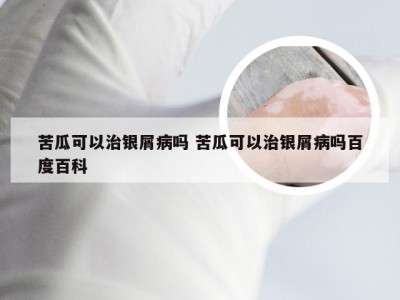 苦瓜可以治银屑病吗 苦瓜可以治银屑病吗百度百科
