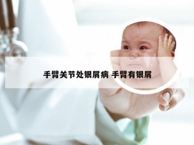 手臂关节处银屑病 手臂有银屑