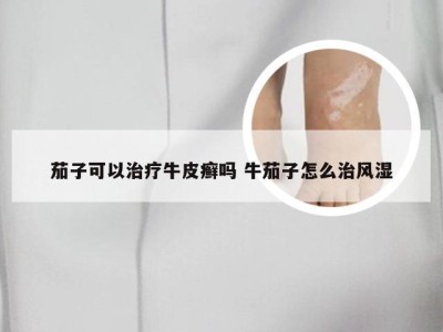 茄子可以治疗牛皮癣吗 牛茄子怎么治风湿