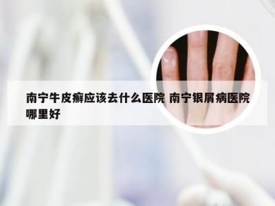 南宁牛皮癣应该去什么医院 南宁银屑病医院哪里好