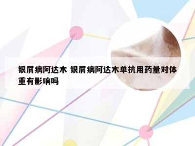 银屑病阿达木 银屑病阿达木单抗用药量对体重有影响吗