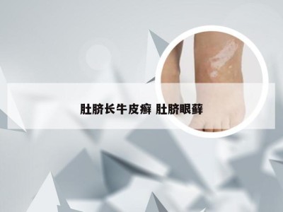 肚脐长牛皮癣 肚脐眼藓