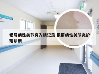 银屑病性关节炎入院记录 银屑病性关节炎护理诊断