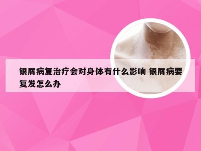 银屑病复治疗会对身体有什么影响 银屑病要复发怎么办