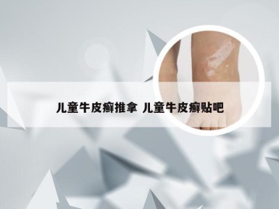 儿童牛皮癣推拿 儿童牛皮癣贴吧