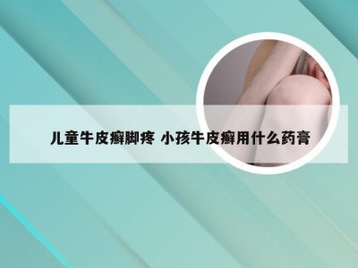 儿童牛皮癣脚疼 小孩牛皮癣用什么药膏