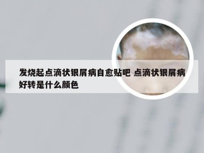 发烧起点滴状银屑病自愈贴吧 点滴状银屑病好转是什么颜色