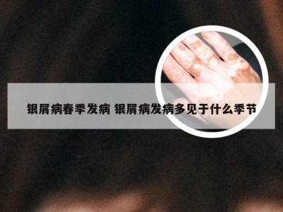 银屑病春季发病 银屑病发病多见于什么季节