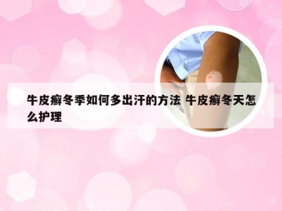 牛皮癣冬季如何多出汗的方法 牛皮癣冬天怎么护理