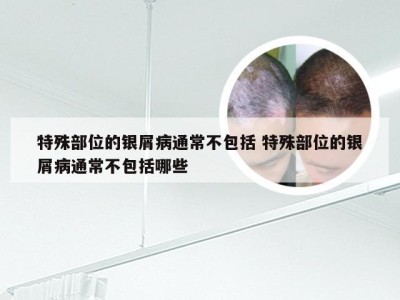 特殊部位的银屑病通常不包括 特殊部位的银屑病通常不包括哪些