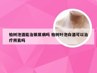 柏树泡酒能治银屑病吗 柏树叶泡白酒可以治疗阴虱吗