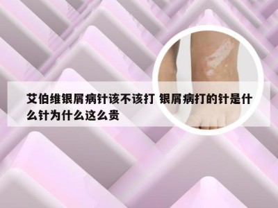 艾伯维银屑病针该不该打 银屑病打的针是什么针为什么这么贵