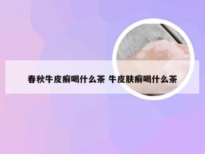 春秋牛皮癣喝什么茶 牛皮肤癣喝什么茶