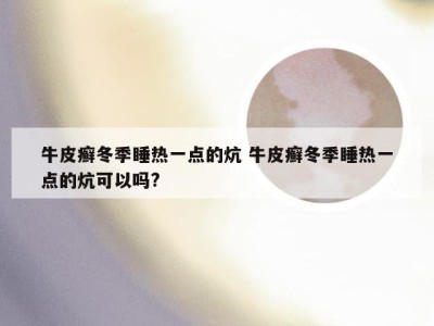 牛皮癣冬季睡热一点的炕 牛皮癣冬季睡热一点的炕可以吗?