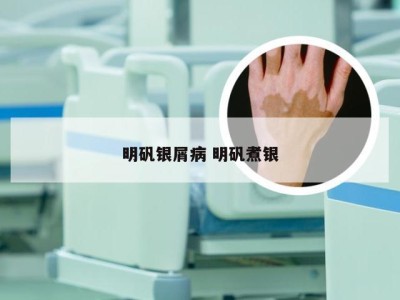 明矾银屑病 明矾煮银
