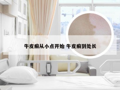 牛皮癣从小点开始 牛皮癣到处长