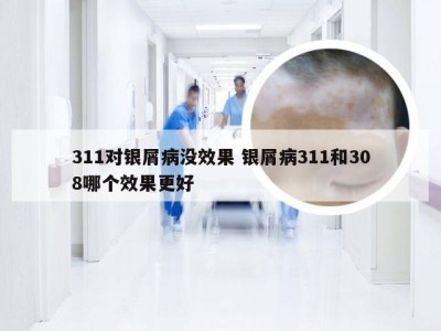 311对银屑病没效果 银屑病311和308哪个效果更好