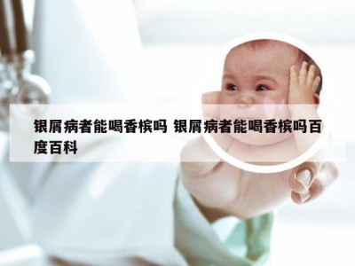 银屑病者能喝香槟吗 银屑病者能喝香槟吗百度百科
