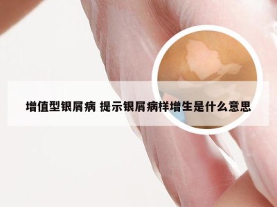增值型银屑病 提示银屑病样增生是什么意思