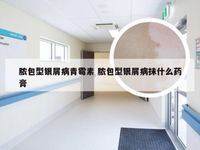 脓包型银屑病青霉素 脓包型银屑病抹什么药膏