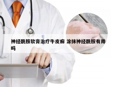 神经酰胺软膏治疗牛皮癣 涂抹神经酰胺有用吗
