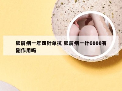 银屑病一年四针单抗 银屑病一针6000有副作用吗