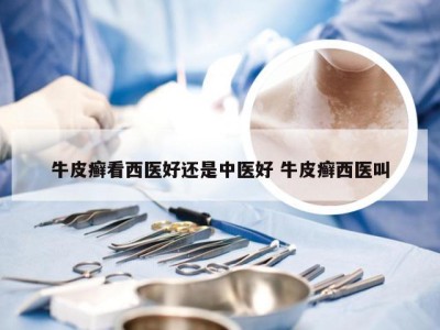 牛皮癣看西医好还是中医好 牛皮癣西医叫