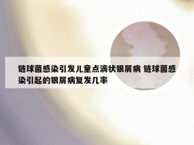 链球菌感染引发儿童点滴状银屑病 链球菌感染引起的银屑病复发几率