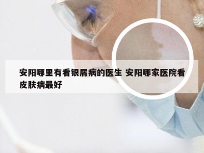 安阳哪里有看银屑病的医生 安阳哪家医院看皮肤病最好