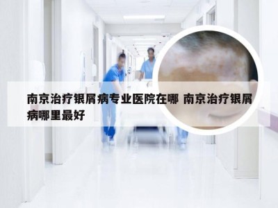 南京治疗银屑病专业医院在哪 南京治疗银屑病哪里最好