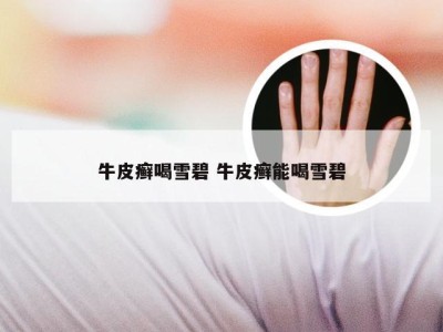 牛皮癣喝雪碧 牛皮癣能喝雪碧