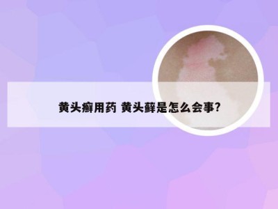 黄头癣用药 黄头藓是怎么会事?