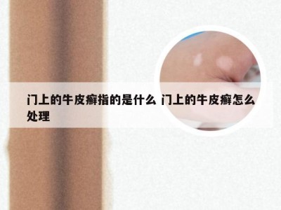 门上的牛皮癣指的是什么 门上的牛皮癣怎么处理