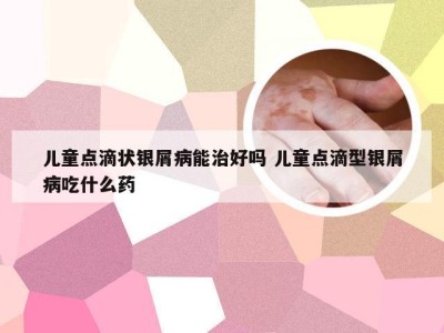 儿童点滴状银屑病能治好吗 儿童点滴型银屑病吃什么药