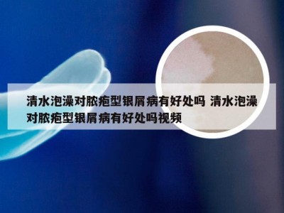 清水泡澡对脓疱型银屑病有好处吗 清水泡澡对脓疱型银屑病有好处吗视频