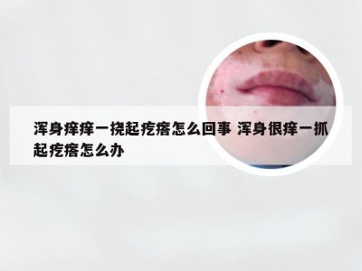 浑身痒痒一挠起疙瘩怎么回事 浑身很痒一抓起疙瘩怎么办