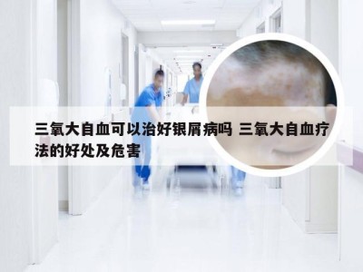 三氧大自血可以治好银屑病吗 三氧大自血疗法的好处及危害