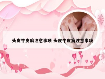 头皮牛皮癣注意事项 头皮牛皮癣注意事项
