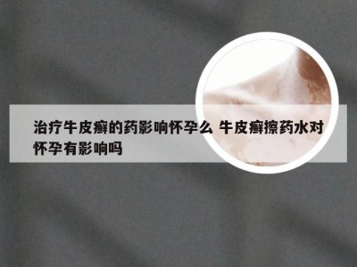 治疗牛皮癣的药影响怀孕么 牛皮癣擦药水对怀孕有影响吗