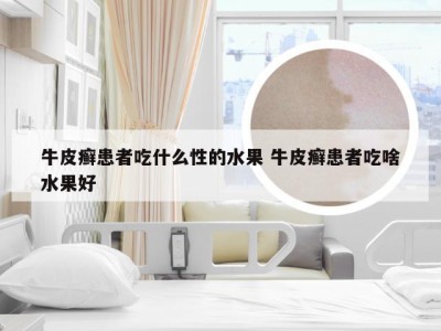 牛皮癣患者吃什么性的水果 牛皮癣患者吃啥水果好