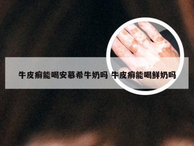 牛皮癣能喝安慕希牛奶吗 牛皮癣能喝鲜奶吗