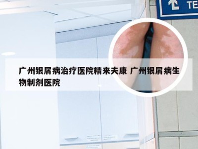 广州银屑病治疗医院精来夫康 广州银屑病生物制剂医院