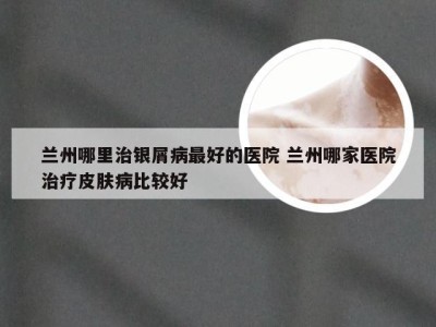 兰州哪里治银屑病最好的医院 兰州哪家医院治疗皮肤病比较好