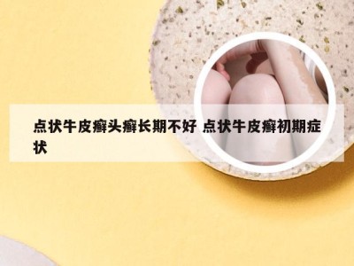 点状牛皮癣头癣长期不好 点状牛皮癣初期症状