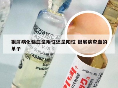 银屑病化验血是阴性还是阳性 银屑病查血的单子